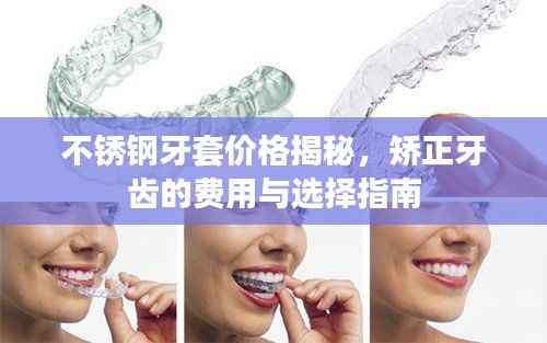 不锈钢牙套价格揭秘，矫正牙齿的费用与选择指南